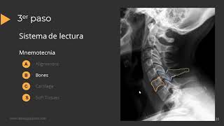 Radiografía de Columna Paso a Paso [upl. by Ylac]