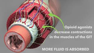 Opioid antidiarrheal medications Loperamide and diphenoxylate [upl. by Marie-Ann]