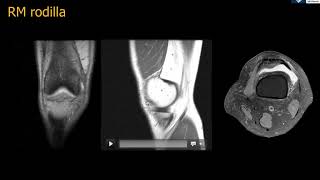 Anatomía RM Rodilla [upl. by Schulein736]