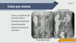 Radiología de Abdomen Estudios Contrastados [upl. by Aznarepse]