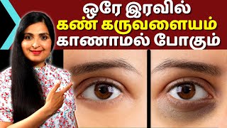 OVERNIGHT Dark Circles Remedy ஒரே இரவில் கருவளையங்களைப் போக்க Undereye Cream Darkcircle [upl. by Ahsineb]