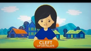 Chapter 3  Understanding Cleft LipPalate Physiology [upl. by Nilla]