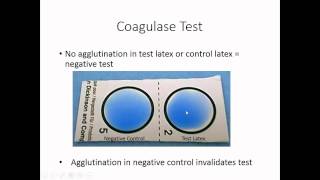 Identification of Staphylococcus [upl. by Eiznek]