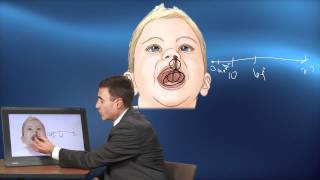 What is a Cleft Palate Dr Brian Kellogg  Nemours KidsHealth [upl. by Mikahs]