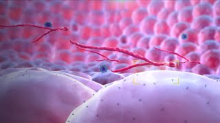 Ebola Virus  Mechanism of Action  3D Medical Animation [upl. by Icyak844]