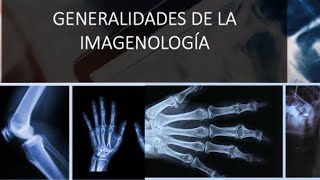 Generalidades de la Imagenología Rx US TAC y RM [upl. by Amarillis]