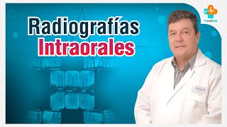 Radiografías Intraorales  Tu Salud Guía [upl. by Tallula]