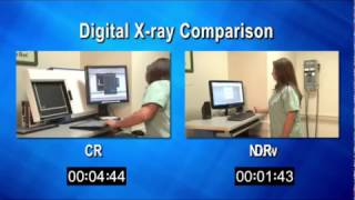 CR amp DR Comparison [upl. by Enovaj]